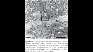 Ultraestructura de la neurona [upl. by Fae]