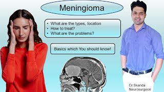 Meningioma Symptoms Treatment Most common benign brain tumor Things U should know By Dr Skanda [upl. by Amalle]