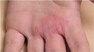 Dermatology Treatments  How to Diagnose Skin Rashes [upl. by Osswald]