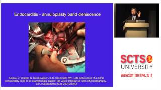 Paravalvular leak transoesophageal echocardiography [upl. by Chemosh523]