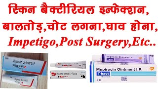 Mupirocin Ointment UsesEffectsSide Effects  Antibiotic Ointment TBactBBactMupiclear [upl. by Nitsur707]