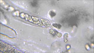 Oomycota zoospores being released from sporangia [upl. by Sothena407]