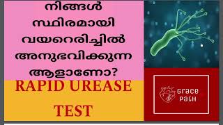 Rapid Urease Test RUT  CLO Test  Helicobacter Pylori Malayalam [upl. by Susej]