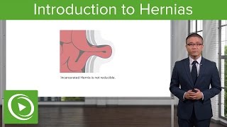 Hernia Introduction – General Surgery  Lecturio [upl. by Etteve856]