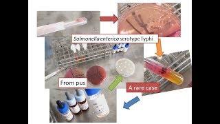 Salmonella from wound swab a rare case report [upl. by Drahcir]