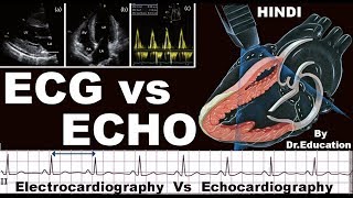 Rx Heart epi 16 h  ECG vs ECHO HINDI Electrocardiography vs Echocardiography DrEducation [upl. by Ahsekyt762]