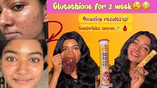 Glutathione ഇത്രയും റിസൾട്ട്‌ തരുമെന്ന് പ്രതീക്ഷിച്ചില്ല 😳💯🙌 2 week experience 🤩🌟 [upl. by Ebbarta]