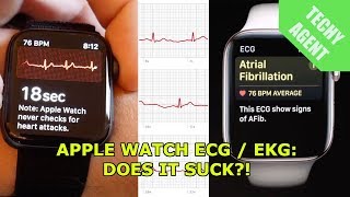 The Apple Watch ECG  EKG sensor  Does it suck [upl. by Laurella]