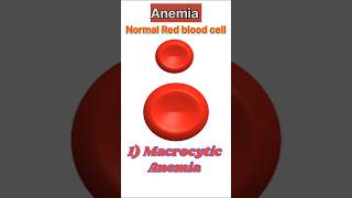 Types of Anemia Common types of anemia anemia youtubeshorts ytshorts shorts [upl. by Bailie]