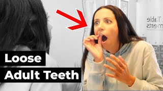 why your teeth feel LOOSE amp what to DO about it [upl. by Darej903]