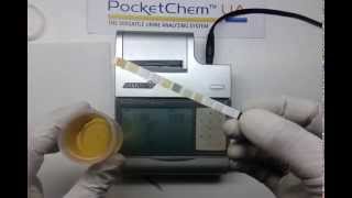 Pocket chem urine analyzer  ACR albumin creatinine ratio [upl. by Dyob470]