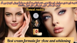 Best cream formula for Acne and whiteningHonest reviewKOMAL beauty voice [upl. by Ahsirt571]