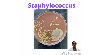 Things to know about Staphylococcus [upl. by Doehne]