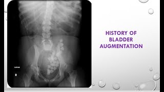 Radiology spotters 1genitourinary15 cases radiology in 15 minutes radiopedia ultrasound ctmri [upl. by Soelch]