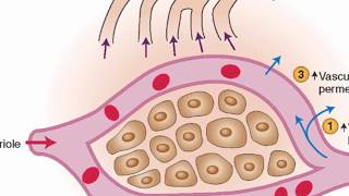 Mechanisms of edema development [upl. by Ettennaej808]