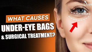 UnderEye Bags Causes and Surgical Treatment Explained by Dr Sudhanshu [upl. by Lacombe]