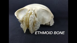 ETHMOID BONE [upl. by Animlehliw79]