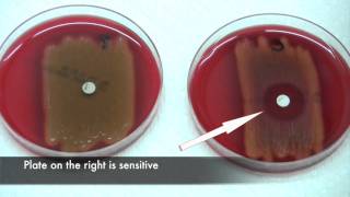 Bacitracin test for Streptococcus pyogenes [upl. by Kaia147]