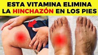 ESTA es LA MEJOR VITAMINA para ELIMINAR la HINCHAZÓN en PIES y PIERNAS [upl. by Siroved]