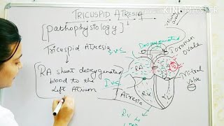 TRICUSPID ATRESIA CONGENITAL HEART DISEASE EASY EXPLANATION  PEDIATRIC NURSING [upl. by Constantino]