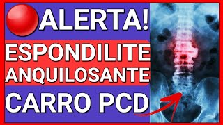 COMO A ESPONDILITE ANQUILOSANTE DÁ DIREITO AO CARRO PCD [upl. by Luapnoj372]