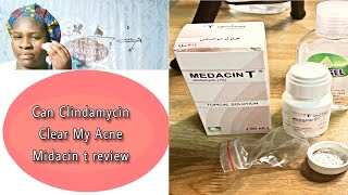 Can Clindamycin Clear My Acne  Midacin T Topical Solution  Review amp How To Use acne midacinT [upl. by Eads]