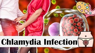 Chlamydia Infection  Causes Risk Factors Transmission Signs amp Symptoms Diagnosis amp Treatment [upl. by Crocker]