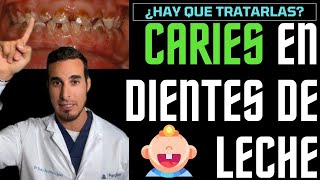 Las CARIES en niños con DIENTES DE LECHE no hace falta tratarlas 🤥¡MENTIRA [upl. by Catlee]