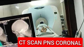 CT Scan PNS Coronal Protocol  CT PNS Scan for Sinusitis How to read CT Scan PNS Coronal View [upl. by Bree]