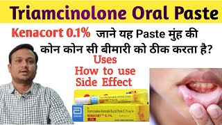 Kenacort 01  Kenacort gel how to use  Triamcinolone oromucosal paste bp 01 ww in hindi [upl. by Akinom401]