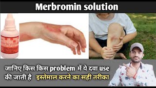 Merbromin solution use benefits and Side effects full review in hindi [upl. by Eirffej144]