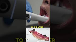 Learn how to scan for an immediate denture [upl. by Jeavons827]