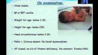 Case presentation on a child with Tyrosinemia [upl. by Alin]