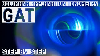 Goldmann applanation Tonometry GAT  basic STEP BY STEP GUIDE [upl. by Onairam]