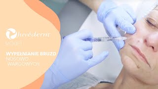 Wypełnianie bruzd nosowowargowych  JUVEDERM® VOLIFT  Klinika VESUNA [upl. by Strenta]