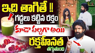 ఇది తాగితే Foods to Improve Blood Levels Reduces Iron Deficiency  Controls Anemia Vikram Aditya [upl. by Yanarp217]