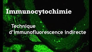 Méthode dimmunofluorescence indirecte [upl. by Dowd]