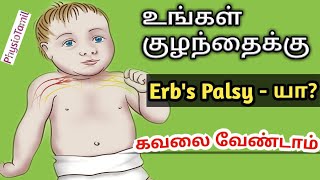 Erbs Palsy என்றால் என்னCausesSymptoms physiotherapy Treatment in TamilDrSasiDuraiPhysioTamil [upl. by Yelyah]