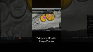 Zirkonzahn Modellier Design dental cadcam digitaldentistry [upl. by Aleron]