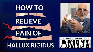 Hallux Rigidus Symptoms Causes and Treatment [upl. by Genesa]