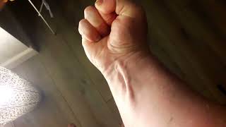 DO YOU HAVE THE EXTRA TENDON  PALMARIS LONGUS MUSCLE  TENDON 💪 [upl. by Llenahs]