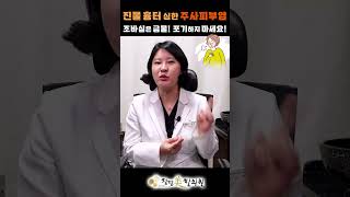 대구 주사피부염 조바심은 금물 포기도 금물  빨간피부 홍조 진물 열오름 가려움 화끈거림  수성범어만촌 안동구미포항울산밀양창원 청담미한의원 [upl. by Jule]