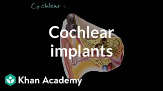 Cochlear implants  Processing the Environment  MCAT  Khan Academy [upl. by Trotter430]