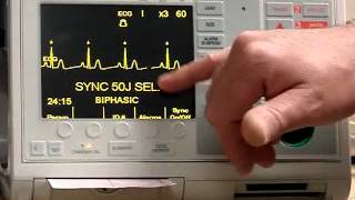 Zoll Defib PM Procedures [upl. by Nevaj]