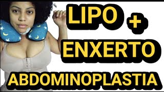 ABDOMINOPLASTIA LIPO ENXERTO VLOG PARTE 2 [upl. by Tare]