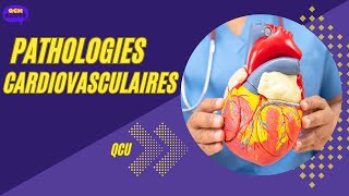 QCU en Pathologies Cardiovasculaires ‐ [upl. by Arhas]