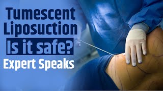 Tumescent Liposuction How safe is tumescent liposuction Expert Speaks  Fat Removal [upl. by Elik575]