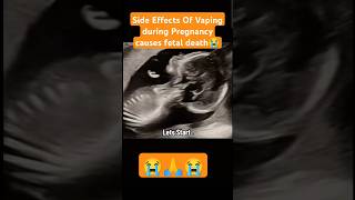 Fetal death😭side effects of vaping during pregnancy😭🙏viralvideo trending viralshorts [upl. by Daveen]