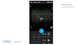 Philips Lumify Ultrasound Guided Injections Video Training Demonstration [upl. by Laurent]