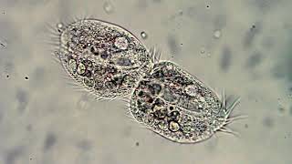 Microorganismos Protozoos Paramecio vorticela Euglena Diatomeas [upl. by Ahsyat620]